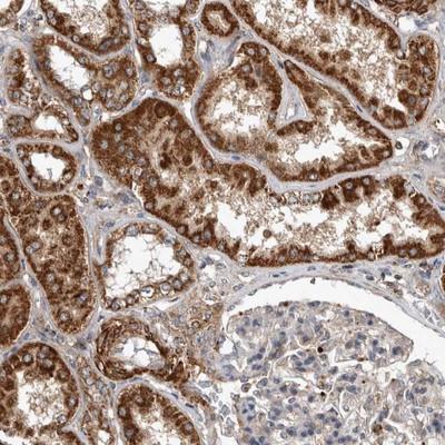 Immunohistochemistry: C7orf62 Antibody [NBP1-82725] - Staining of human kidney shows strong granular cytoplasmic positivity in tubular cells.