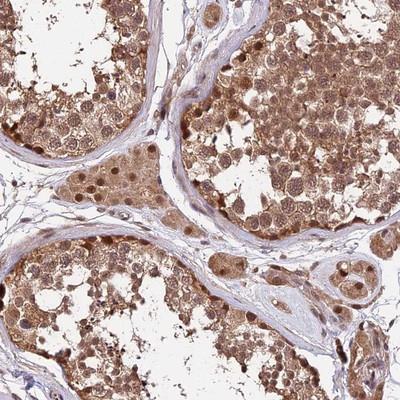 Immunohistochemistry: C16orf78 Antibody [NBP1-82713] - Staining of human testis shows moderate cytoplasmic and nuclear positivity in cells of seminiferus ducts.