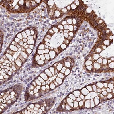 Immunohistochemistry: Exportin-T Antibody [NBP2-13528] - Staining of human rectum shows strong cytoplasmic and membranous positivity in glandular cells.