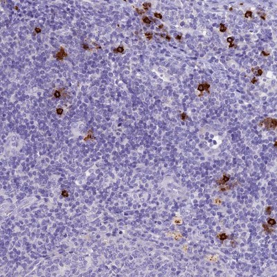 Immunohistochemistry-Paraffin: Eukaryotic translation initiation factor 1 Antibody [NBP2-13950] Staining of human tonsil shows strong cytoplasmic positivity in a subset of non-germinal center cells.