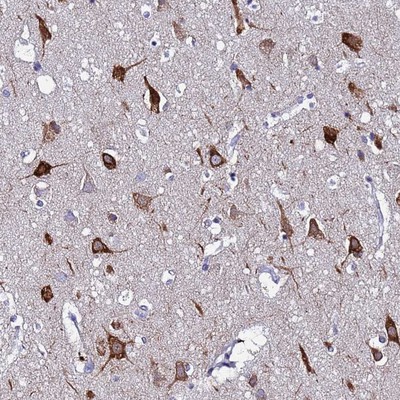 Immunohistochemistry-Paraffin: C9orf153 Antibody [NBP1-94130] Staining of human cerebral cortex shows strong cytoplasmic positivity in neuronal cells.