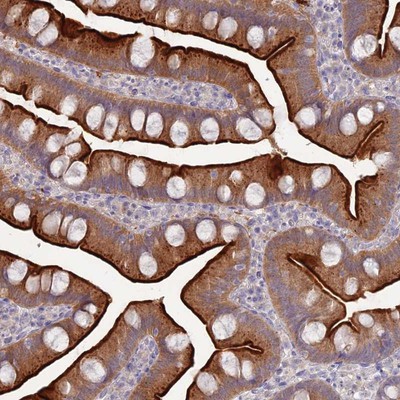 Immunohistochemistry-Paraffin: C9orf57 Antibody [NBP1-94163] Staining of human small intestine shows strong luminal membranous and cytoplasmic positivity in glandular cells.