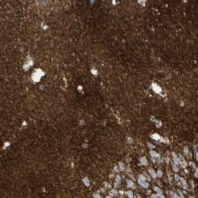 Immunohistochemistry: ATPase Na+/K+ beta 2 Antibody [NBP1-90174] - Immunohistochemical staining of human hippocampus shows distinct positivity in neuropil.