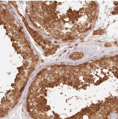 Immunohistochemistry: C11orf20 Antibody [NBP2-30895] - Immunohistochemical staining of human testis shows strong cytoplasmic positivity in cells in seminiferus ducts and Leydig cells.