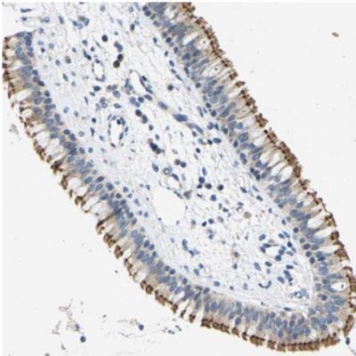 Immunohistochemistry: C19orf174 Antibody [NBP2-31003] - Immunohistochemical staining of human nasopharynx shows strong membranous positivity in respiratory epithelial cells.