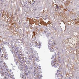 Immunohistochemistry-Paraffin: Collagen, Type X, Alpha 1 Antibody [NBP2-30987] - Human prostate.