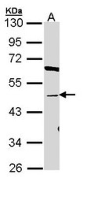 Western Blot: BAAT Antibody [NBP1-32913] - Western blot analysis of BAAT on Hep G2 lysate using NBP1-32913 at a dilution of 1:1000. 30ug of whole cell lysate loaded on 10% SDS PAGE gel.
