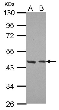 Western Blot: Host cell factor C2 Antibody [NBP2-16871] - Sample (30 ug of whole cell lysate) A: NT2D1 B: IMR32 10% SDS PAGE gel, diluted at 1:500.