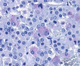 Immunohistochemistry: PACAP Receptor Antibody [NLS948] - Staining of human brain, pituitary using this antibody at 15 ug/ ml.