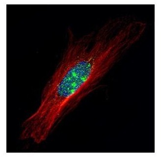 Immunocytochemistry/Immunofluorescence: ZFP64 Antibody [NBP2-20945] - Confocal immunofluorescence analysis of paraformaldehyde-fixed HeLa, using ZFP64 antibody (Green) at 1:500 dilution. Alpha-tubulin filaments are labeled with Alpha-tubulin antibody (Red) at 1:2000.