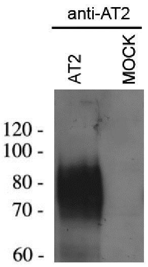Western Blot: Angiotensin II Type 2 Receptor Antibody [NBP1-49568]