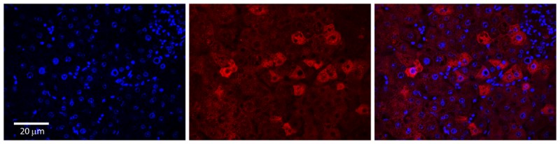 Immunocytochemistry/Immunofluorescence: CYP4F3 Antibody [NBP1-69678] - Antibody  Formalin Fixed Paraffin Embedded Tissue: Human Adult Liver  Observed Staining: Cytoplasm in hepatocytes, strong signal, moderate tissue distribution