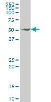 Western Blot: CBF1-interacting corepressor Antibody [H00009541-A01] - Western Blot analysis of CIR expression in HeLa ( Cat # L013V1 ).