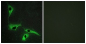 Immunocytochemistry/Immunofluorescence: TM4SF3 Antibody [NBP1-55579] - Analysis of HeLa cells, using TM4SF3 Antibody. The picture on the right is treated with the synthesized peptide.