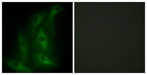 Immunocytochemistry/Immunofluorescence: COL4A6 Antibody [NBP1-55799] - Analysis of HeLa cells, using COL4A6 Antibody. The picture on the right is treated with the synthesized peptide.