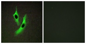 Immunocytochemistry/Immunofluorescence: STEAP4 Antibody [NBP1-68081] - Analysis of HeLa cells, using STEAP4 Antibody. The picture on the right is treated with the synthesized peptide.