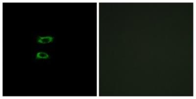 Immunocytochemistry/Immunofluorescence: BMP-8a Antibody [NBP1-68407] - Analysis of A549 cells, using BMP8-a Antibody. The picture on the right is treated with the synthesized peptide.