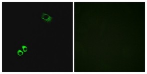 Immunocytochemistry/Immunofluorescence: GPRC6A Antibody [NBP1-71071] - Analysis of MCF7 cells, using GPRC6A Antibody. The picture on the right is treated with the synthesized peptide.