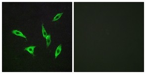 Immunocytochemistry/Immunofluorescence: Adenosine A2b Receptor Antibody [NBP1-70990] - Analysis of LOVO cells, using Adenosine A2b Receptor Antibody. The picture on the right is treated with the synthesized peptide.