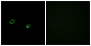 Immunocytochemistry/Immunofluorescence: OR10AG1 Antibody [NBP1-71128] - Analysis of MCF7 cells, using OR10AG1 Antibody. The picture on the right is treated with the synthesized peptide.