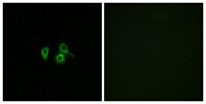 Immunocytochemistry/Immunofluorescence: OR10H4 Antibody [NBP1-71177] - Analysis of A549 cells, using OR10H4 Antibody. The picture on the right is treated with the synthesized peptide.
