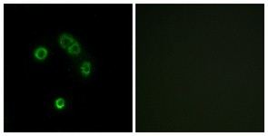 Immunocytochemistry/Immunofluorescence: TAS2R13 Antibody [NBP1-71303] - Analysis of MCF7 cells, using TAS2R13 Antibody. The picture on the right is treated with the synthesized peptide.