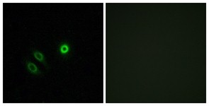 Immunocytochemistry/Immunofluorescence: OR4X1 Antibody [NBP1-71232] - Analysis of A549 cells, using OR4X1 Antibody. The picture on the right is treated with the synthesized peptide.