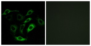 Immunocytochemistry/Immunofluorescence: Prostaglandin D2 Receptor Antibody [NBP1-71366] - Analysis of A549 cells, using Prostaglandin D2 Receptor Antibody. The picture on the right is treated with the synthesized peptide.