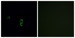 Immunocytochemistry/Immunofluorescence: OR9Q1 Antibody [NBP1-71277] - Analysis of MCF7 cells, using OR9Q1 Antibody. The picture on the right is treated with the synthesized peptide.