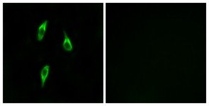 Immunocytochemistry/Immunofluorescence: OR51B2 Antibody [NBP1-71356] - Analysis of LOVO cells, using OR51B2 Antibody. The picture on the right is treated with the synthesized peptide.