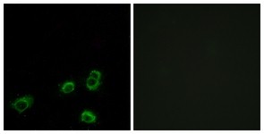 Immunocytochemistry/Immunofluorescence: OR52A1 Antibody [NBP1-71339] - Analysis of MCF7 cells, using OR52A1 Antibody. The picture on the right is treated with the synthesized peptide.