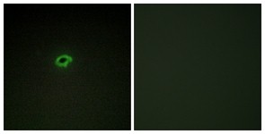 Immunocytochemistry/Immunofluorescence: Collagen IV alpha4 Antibody [NBP1-71564] - Analysis of COS7 cells, using Collagen IV alpha4 Antibody. The picture on the right is treated with the synthesized peptide.