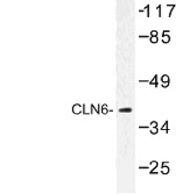 Western Blot: CLN6 Antibody [NBP1-00759] - Western blot (WB) analysis of CLN6 (N258) antibody in extracts from HeLa cells.
