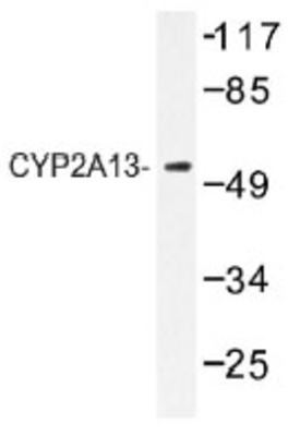 Western Blot: CYP2A13 Antibody [NB100-92424] - Western blot (WB) analyzes of CYP2A13 (N338)  antibody in extracts from HeLa cells