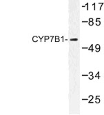 Western Blot: CYP7B1 Antibody [NBP1-00774] - Western blot (WB) analysis of CYP7B1 (Q127) antibody in extracts from LOVO cells