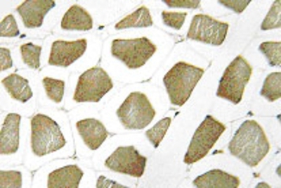 Immunohistochemistry: CYP7B1 Antibody [NBP1-00774] - Immunohistochemistry (IHC) analyzes of CYP7B1 (Q127) antibody in paraffin-embedded human skeletal muscle tissue .