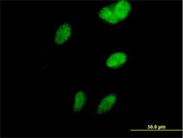 Immunocytochemistry/Immunofluorescence: Vinexin Antibody [H00010174-B01P] - Immunofluorescence of purified MaxPab antibody to SORBS3 on HeLa cell. [antibody concentration 10 ug/ml]