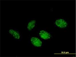 Immunocytochemistry/Immunofluorescence: FNBP3 Antibody [H00055660-B02] - Immunofluorescence of purified MaxPab antibody to PRPF40A on HeLa cell. [antibody concentration 10 ug/ml]
