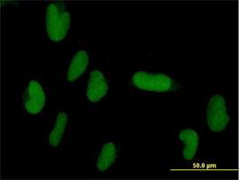 Immunocytochemistry/Immunofluorescence: ZNF193 Antibody [H00007746-B01] - Immunofluorescence of purified MaxPab antibody to ZNF193 on HepG2 cell. [antibody concentration 10 ug/ml]