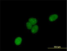 Immunocytochemistry/Immunofluorescence: LRIF1 Antibody [H00055791-B01] - Immunofluorescence of purified MaxPab antibody to C1orf103 on HeLa cell. [antibody concentration 10 ug/ml]