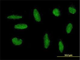 Immunocytochemistry/Immunofluorescence: ZNF383 Antibody [H00163087-B01] - Immunofluorescence of purified MaxPab antibody to ZNF383 on HepG2 cell. [antibody concentration 10 ug/ml]