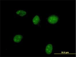 Immunocytochemistry/Immunofluorescence: HGD Antibody [H00003081-B01] - Immunofluorescence of purified MaxPab antibody to HGD on HeLa cell. [antibody concentration 10 ug/ml]