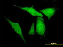 Immunocytochemistry/Immunofluorescence: KCNIP4 Antibody [H00080333-B01] - Immunofluorescence of purified MaxPab antibody to KCNIP4 (Cat# H00080333-B01) on HeLa cell . [antibody concentration 10 ug/ml]