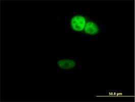 Immunocytochemistry/Immunofluorescence: ZNF124 Antibody [H00007678-B01] - ZNF124 ( Cat# H00007678-B01 ) on HeLa cell . [antibody concentration 10 ug/ml]