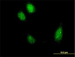 Immunocytochemistry/Immunofluorescence: DYDC2 Antibody [H00084332-B01] - Immunofluorescence of purified MaxPab antibody to MGC16186 (Cat# H00084332-B01) on HeLa cell . [antibody concentration 10 ug/ml]