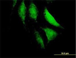 Immunocytochemistry/Immunofluorescence: HECTD2 Antibody [H00143279-B01] - Immunofluorescence of purified MaxPab antibody to HECTD2 ( Cat# H00143279-B01 ) on HeLa cell . [antibody concentration 10 ug/ml]