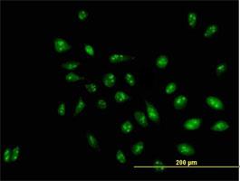 Immunocytochemistry/Immunofluorescence: RRP1 Antibody [H00008568-B01] - Immunofluorescence of purified MaxPab antibody to D21S2056E on HeLa cell. [antibody concentration 10 ug/ml]