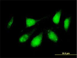 Immunocytochemistry/Immunofluorescence: RERG Antibody [H00085004-B01] - RERG (Cat# H00085004-B01) on HeLa cell . [antibody concentration 10 ug/ml]