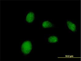 Immunocytochemistry/Immunofluorescence: NANP Antibody [H00140838-B01] - Immunofluorescence of purified MaxPab antibody to NANP on HeLa cell. [antibody concentration 10 ug/ml]