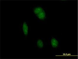 Immunocytochemistry/Immunofluorescence: FTSJ1 Antibody [H00024140-B01] - Immunofluorescence of purified MaxPab antibody to FTSJ1 on HeLa cell. [antibody concentration 10 ug/ml]